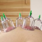 cupping ls 2